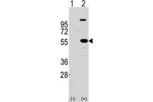 Image no. 2 for anti-Aldehyde Dehydrogenase 1 Family, Member A1 (ALDH1A1) (Center) antibody (ABIN356973) (ALDH1A1 Antikörper  (Center))