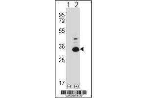 Western blot analysis of Tp53rk using rabbit polyclonal Mouse Tp53rk Antibody using 293 cell lysates (2 ug/lane) either nontransfected (Lane 1) or transiently transfected (Lane 2) with the Tp53rk gene. (TP53RK Antikörper  (AA 100-128))