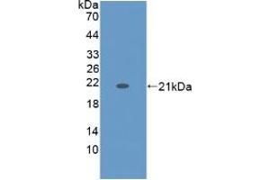 Western Blotting (WB) image for Keratin 9 (KRT9) ELISA Kit (ABIN6720501)