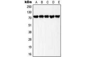 Western blot analysis of LIMK1/2 (pT508/505) expression in HeLa UV-treated (A), Raw264. (LIMK-1/2 (C-Term), (pSer505), (pSer508) Antikörper)