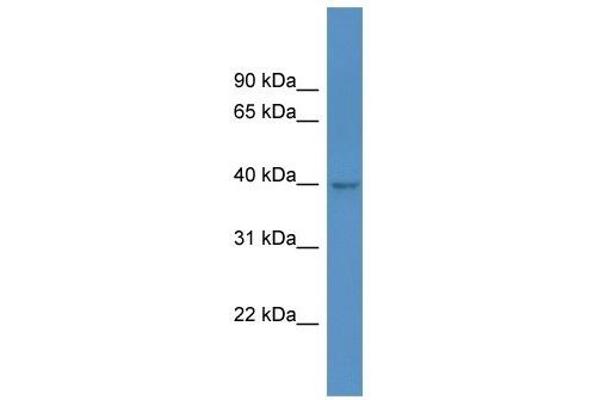 HPDL Antikörper  (C-Term)