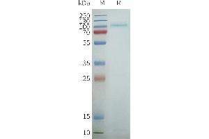 Human R2-Nanodisc, Flag Tag on SDS-PAGE (TAS1R2 Protein)