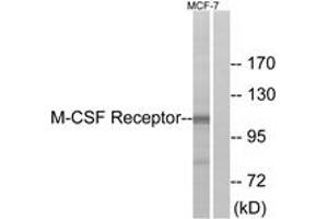 Western Blotting (WB) image for anti-Colony Stimulating Factor 1 Receptor (CSF1R) (AA 691-740) antibody (ABIN2888738) (CSF1R Antikörper  (AA 691-740))