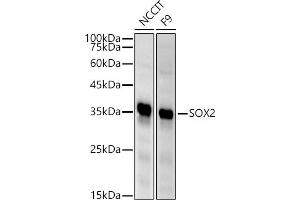 Western blot analysis of extracts of various cell lines, using SOX2 antibody (ABIN6130648, ABIN6148295, ABIN6148297 and ABIN6215241) at 1:500 dilution. (SOX2 Antikörper  (AA 1-140))