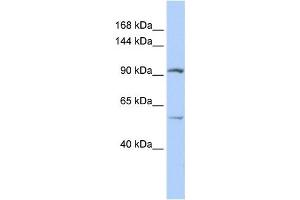 Western Blotting (WB) image for anti-Leucine Rich Repeat Containing 66 (LRRC66) antibody (ABIN2458886) (LRRC66 Antikörper)