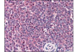 Human Spleen (formalin-fixed, paraffin-embedded) stained with CARD11at 2 µg/ml followed by biotinylated anti-goat IgG secondary antibody, alkaline phosphatase-streptavidin and chromogen. (CARD11 Antikörper  (C-Term))