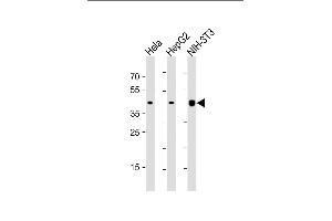 Western Blotting (WB) image for anti-Actin, beta (ACTB) antibody (ABIN658990)