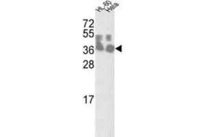 Western Blotting (WB) image for anti-Chloride Channel, Nucleotide-Sensitive, 1A (CLNS1A) antibody (ABIN3002661) (CLNS1A Antikörper)