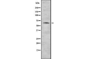 Western blot analysis of K2C1 expression in HEK293 cells ,The lane on the left is treated with the antigen-specific peptide. (Cytokeratin 1 Antikörper  (N-Term))