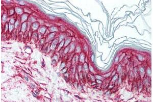 Human Skin (formalin-fixed, paraffin-embedded) stained with CD9 antibody ABIN241562 at 10 ug/ml followed by biotinylated anti-mouse IgG secondary antibody ABIN481714, alkaline phosphatase-streptavidin and chromogen. (CD9 Antikörper)