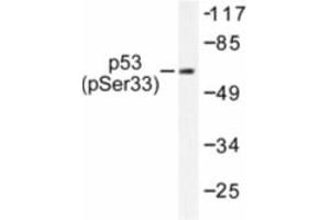 Image no. 1 for anti-Tumor Protein P53 (TP53) (pSer33) antibody (ABIN318093) (p53 Antikörper  (pSer33))