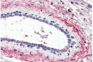 Human Breast (formalin-fixed, paraffin-embedded) stained with WNT3 antibody ABIN461935 at 3. (WNT3 Antikörper  (AA 315-329))