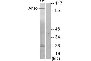 Immunohistochemistry analysis of paraffin-embedded human thyroid gland tissue using AhR (Ab-36) antibody. (Aryl Hydrocarbon Receptor Antikörper)