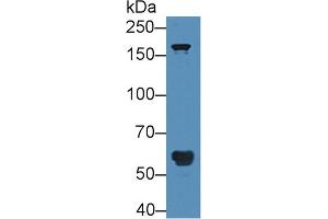 Western Blot; Sample: Human Serum; Primary Ab: 5µg/ml Rabbit Anti-Human POTEG Antibody Second Ab: 0. (POTEG Antikörper  (AA 177-330))
