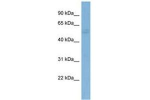 Image no. 1 for anti-GTPase Activating Protein (SH3 Domain) Binding Protein 1 (G3BP1) (AA 107-156) antibody (ABIN6742009) (G3BP1 Antikörper  (AA 107-156))