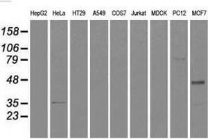 Western blot analysis of extracts (35 µg) from 9 different cell lines by using anti-CD4 monoclonal antibody. (CD4 Antikörper)