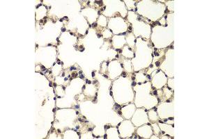 Immunohistochemistry of paraffin-embedded mouse lung using PHF11 antibody at dilution of 1:100 (x400 lens). (PHF11 Antikörper)