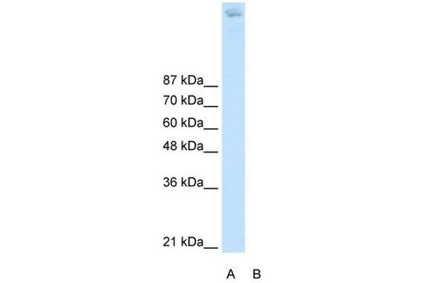 ZBTB38 Antikörper  (N-Term)