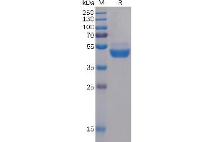 Human TIGIT Protein, mFc Tag on SDS-PAGE under reducing condition. (TIGIT Protein (AA 22-141) (mFc Tag))