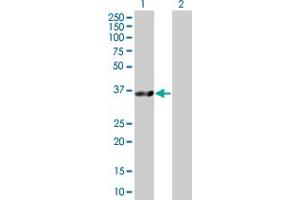 Lane 1: FBP1 transfected lysate ( 36. (FBP1 293T Cell Transient Overexpression Lysate(Denatured))