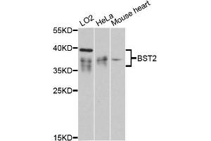 Western blot analysis of extracts of various cell lines, using BST2 antibody (ABIN5997320) at 1:3000 dilution. (BST2 Antikörper)