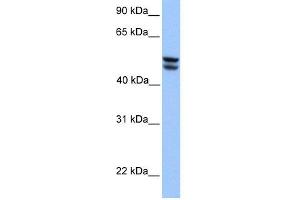 WB Suggested Anti-OXCT1 Antibody Titration:  0. (OXCT1 Antikörper  (Middle Region))