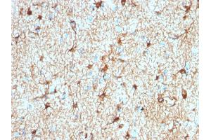 Immunohistochemistry (IHC) image for anti-Glial Fibrillary Acidic Protein (GFAP) antibody (ABIN6939509)