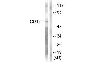 Western Blotting (WB) image for anti-CD19 Molecule (CD19) (Tyr531) antibody (ABIN1847935) (CD19 Antikörper  (Tyr531))