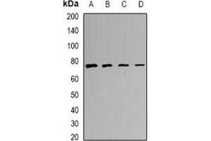 Western blot analysis of CALCOCO1 expression in MCF7 (A), A549 (B), mouse lung (C), mouse heart (D) whole cell lysates. (CALCOCO1 Antikörper)