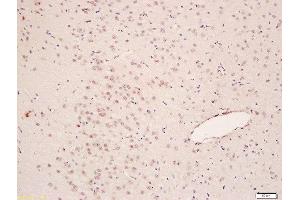 Formalin-fixed and paraffin embedded rat brain labeled with Anti-pan methyl Lysine Polyclonal Antibody, Unconjugated  at 1:200 followed by conjugation to the secondary antibody and DAB staining (Methylated Lysine (methylated) Antikörper)