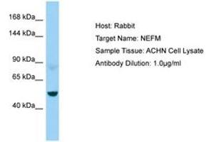 Image no. 1 for anti-Neurofilament Triplet M Protein (NEFM) (AA 429-478) antibody (ABIN6750015) (NEFM Antikörper  (AA 429-478))