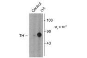 Image no. 1 for anti-Tyrosine Hydroxylase (TH) (pSer31) antibody (ABIN227933) (Tyrosine Hydroxylase Antikörper  (pSer31))