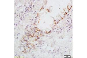 Immunohistochemistry (Paraffin-embedded Sections) (IHC (p)) image for anti-Fas Ligand (TNF Superfamily, Member 6) (FASL) (AA 196-281) antibody (ABIN726410)