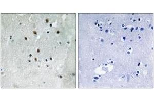 Immunohistochemistry analysis of paraffin-embedded human brain, using SRF (Phospho-Ser77) Antibody. (SRF Antikörper  (pSer77))