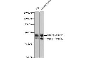Western blot analysis of extracts of various cell lines, using MEF2A+MEF2C antibody (ABIN1679049, ABIN1679050, ABIN7101495 and ABIN7101496) at 1:1000 dilution. (MEF2A+MEF2C Antikörper)