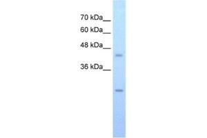 Western Blotting (WB) image for anti-FLJ20489 antibody (ABIN2462594) (FLJ20489 Antikörper)