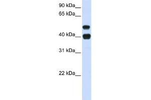 WB Suggested Anti-USP22 Antibody Titration: 0. (USP22 Antikörper  (N-Term))