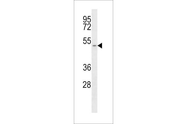 SLC16A1 Antikörper  (C-Term)