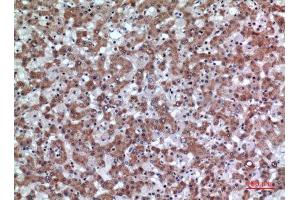 Immunohistochemistry (IHC) image for anti-CD200 (CD200) (Internal Region) antibody (ABIN3187966)