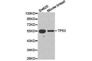 Western Blotting (WB) image for anti-Tumor Protein P53 (TP53) antibody (ABIN1875168) (p53 Antikörper)