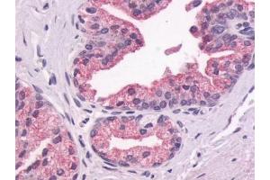 Immunohistochemical staining of Prostate (Epithelium) using anti- GPR87 antibody ABIN122192 (GPR87 Antikörper  (N-Term))