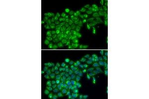 Immunofluorescence analysis of MCF7 cell using TNFSF13 antibody. (TNFSF13 Antikörper)