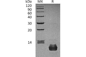 Greater than 95 % as determined by reducing SDS-PAGE. (CCL27 Protein)