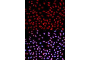 Immunofluorescence analysis of U2OS cells using POLH antibody (ABIN5970934). (POLH Antikörper)