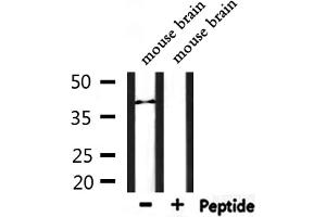 Western blot analysis of extracts from mouse brain, using P2RY5 Antibody. (LPAR6 Antikörper  (Internal Region))