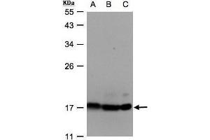 WB Image Sample(30 ug whole cell lysate) A:Hep G2, B:MOLT4, C:Raji, 12% SDS PAGE antibody diluted at 1:500 (ATP Synthase delta (Center) Antikörper)