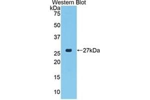 Detection of Recombinant CTGF, Porcine using Polyclonal Antibody to Connective Tissue Growth Factor (CTGF) (CTGF Antikörper  (AA 101-330))