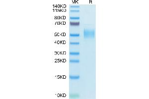 Human PLA2G7 on Tris-Bis PAGE under reduced condition. (PLA2G7 Protein (AA 22-441) (His tag))