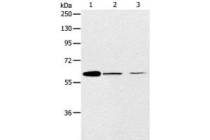 Western Blot analysis of NIH/3T3 and SKOV3 cell, Human ovarian cancer tissue using ABCE1 Polyclonal Antibody at dilution of 1:450 (ABCE1 Antikörper)