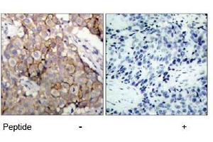 Image no. 1 for anti-Epidermal Growth Factor Receptor (EGFR) (Tyr1092) antibody (ABIN197231) (EGFR Antikörper  (Tyr1092))